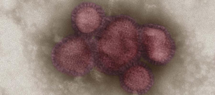 Influenza.jpg